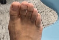 Artiest Jamaicanfeetd0m Foto 1