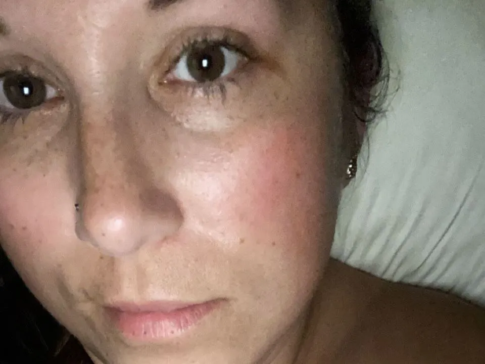 NOLAPineapple profilbild på webbkameramodell