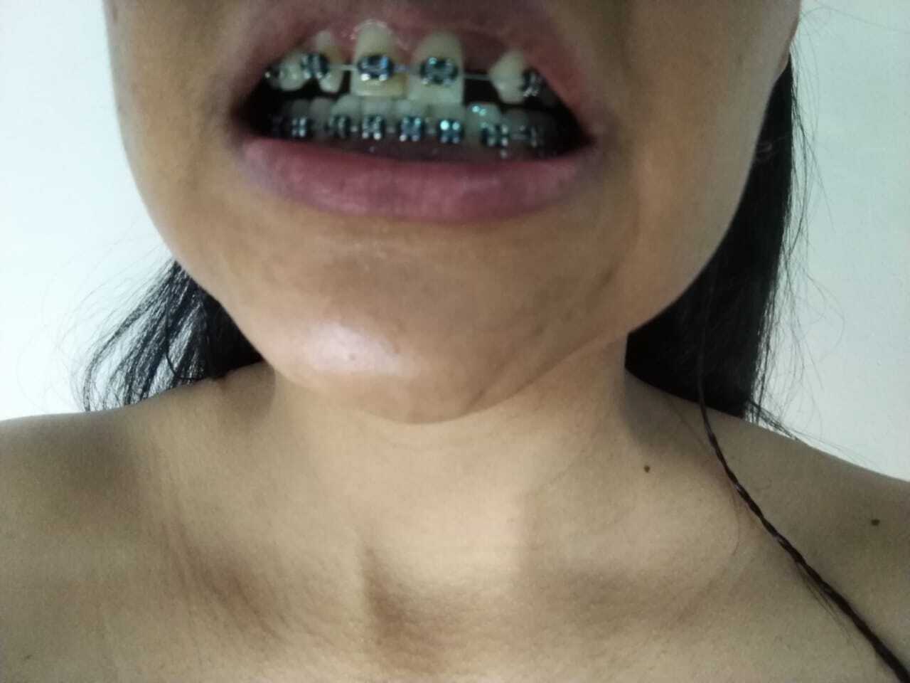 Artiest miisslondoon Foto 3