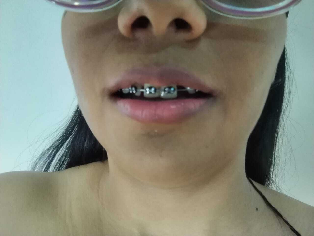 Artiest miisslondoon Foto 1