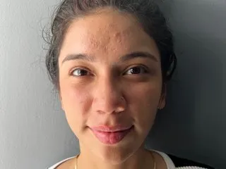 Amyglow_pk profilbild på webbkameramodell