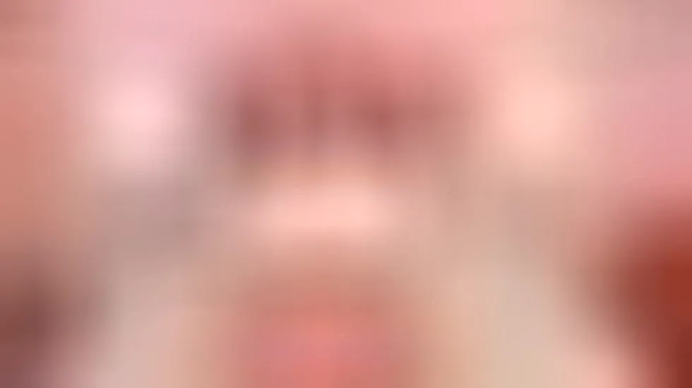 Teaser video 35