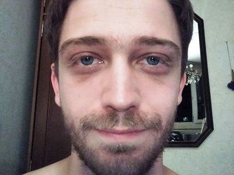 ShadownovisadXX profilbild på webbkameramodell 