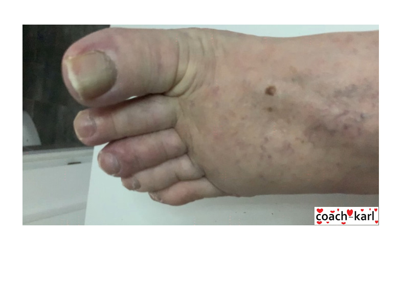 Interprète CoachKarl Photo 10