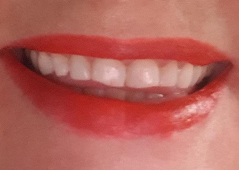 Utøver Missy40 Bilde 2